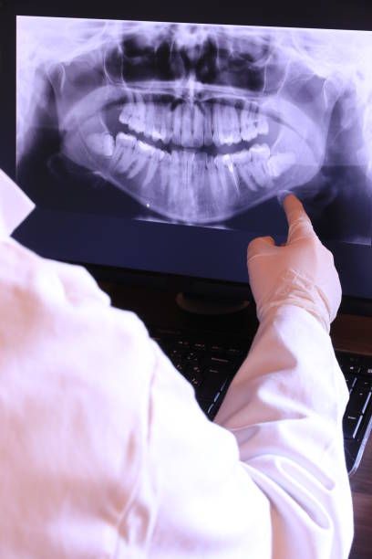 Best Urgent Care for Lost Fillings or Crowns in Whitestown, IN